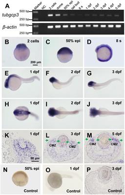 Tubgcp3 Is Required for Retinal Progenitor Cell Proliferation During Zebrafish Development